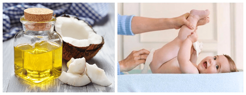 4 cách trị hăm tã cho trẻ sơ sinh bằng dầu dừa hiệu quả tại nhà